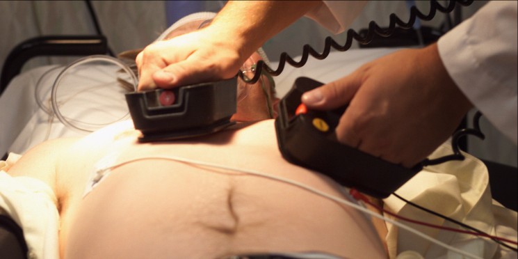 Doenças cardiovasculares são a principal causa de morte no Brasil